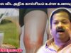 பாலை விட Calcium அதிகமுள்ள உணவுகள் | Dr.Sivaraman – Calcium rich foods than milk | Bone strength
