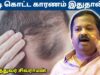 முடி கொட்ட காரணம் இதுதான் | Dr.Sivaraman speech on hairfall remedy – Oil bathing